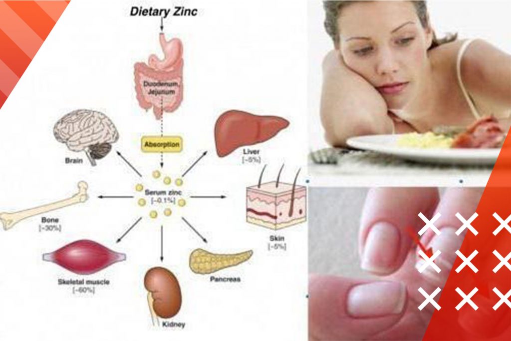 Zinc-Roids101-4