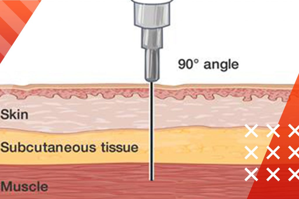 how to inject steroids guide 3