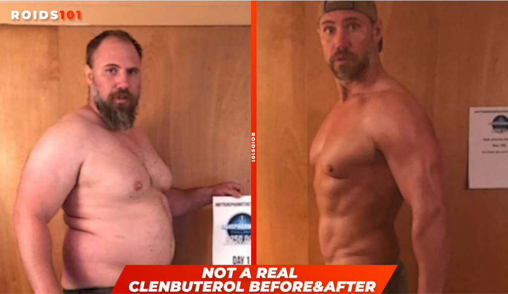 clenbuterol before and after another bad example