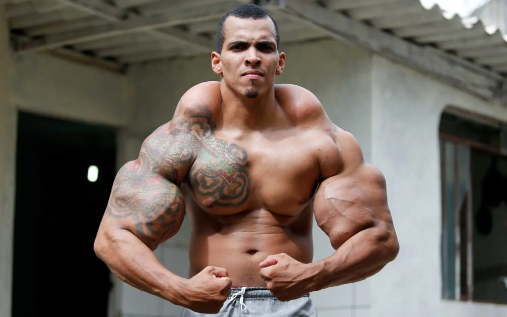 Man with synthol arms injections